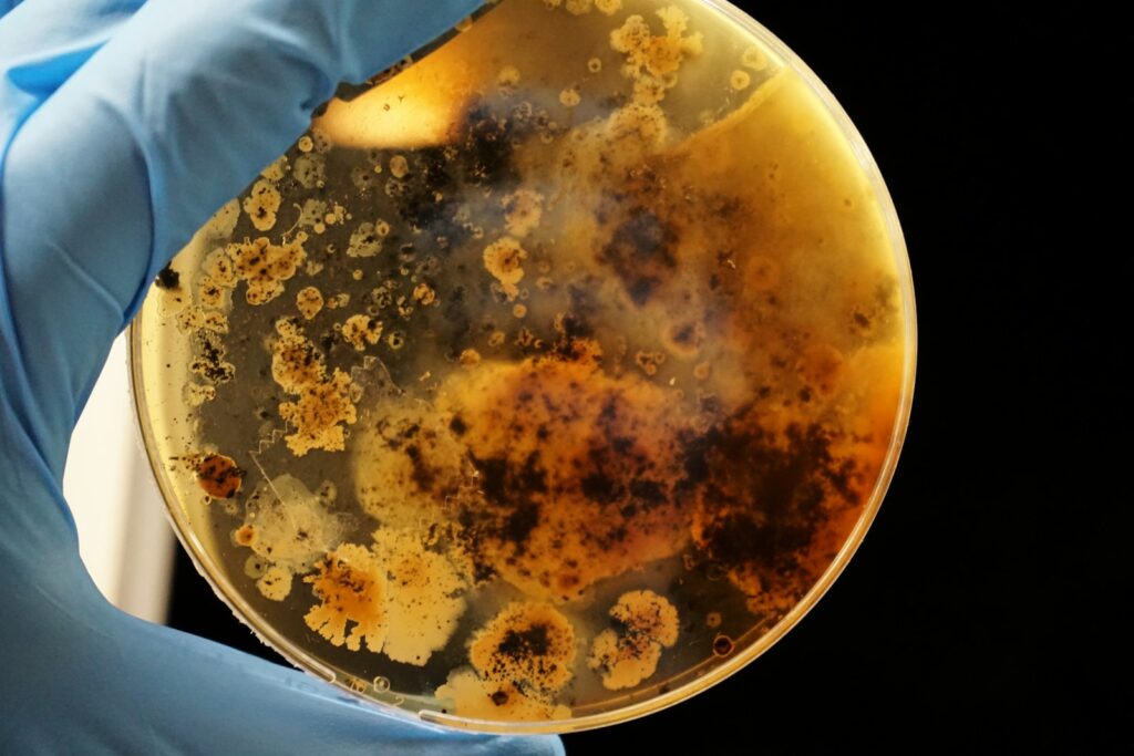 Concetti microbiologici, Legionella pneumophila